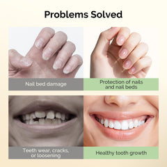 MelodySusie nail biting treatment brush-head highlights easy, mess-free application.