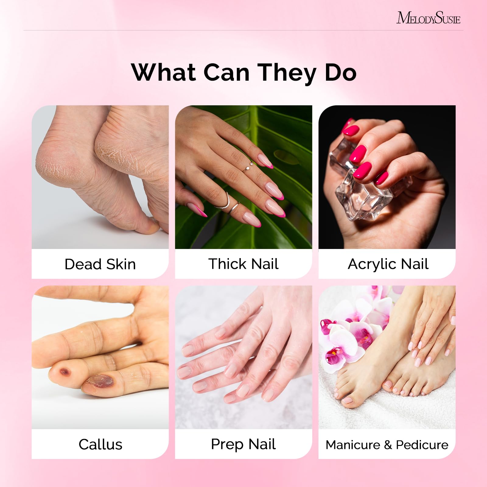 MelodySusie sanding bands closeup highlighting durable material and long-lasting performance.