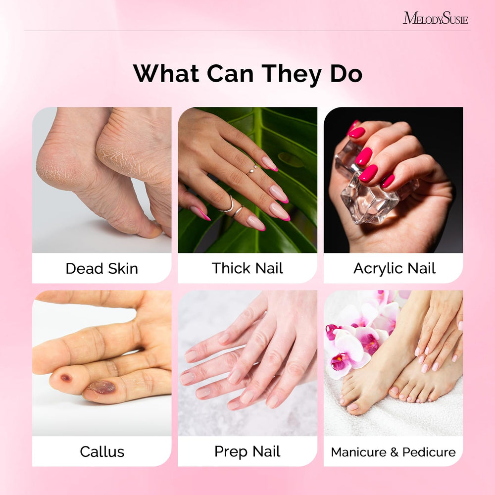 MelodySusie sanding bands closeup highlighting durable material and long-lasting performance.