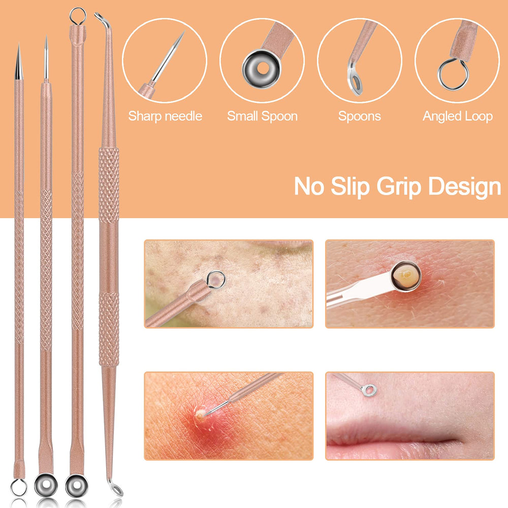 MENOLY stainless steel acne tools with anti-slip handles for control.