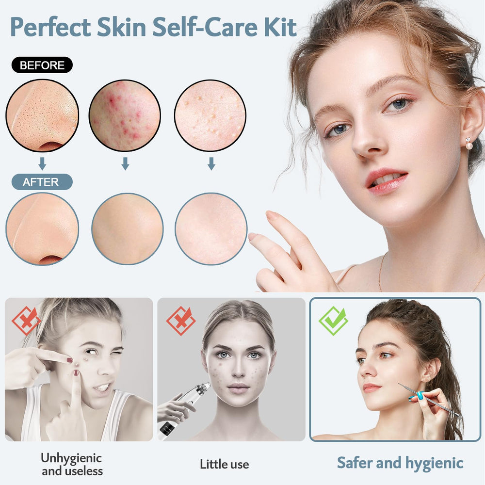 MENOLY stainless-steel blackhead remover-tools in hand for hygienic, controlled extraction.