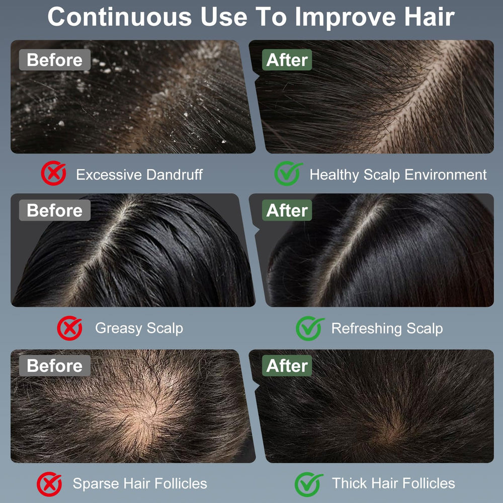 MERNUNUX-48-soft-massage-heads-scalp-massager provides gentle, even contact on the scalp.