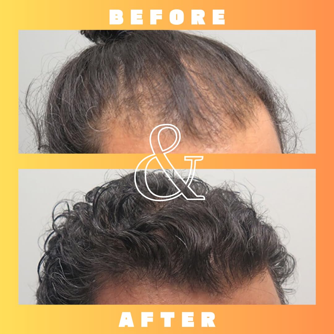 Mettle Mane RU58841 application scene suggests simple scalp treatment.