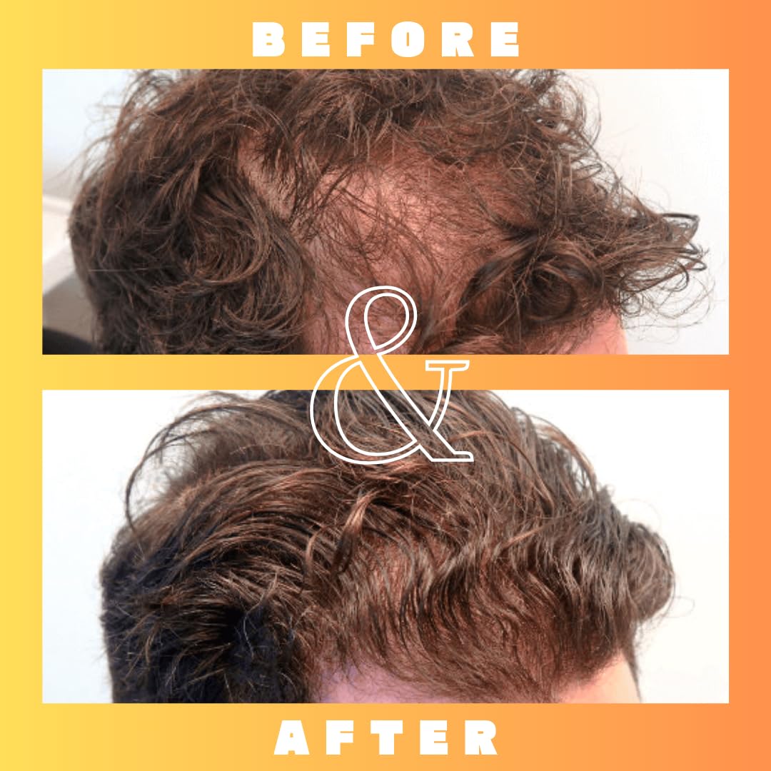 Mettle Mane RU58841 scalp closeup illustrates product contact with skin.