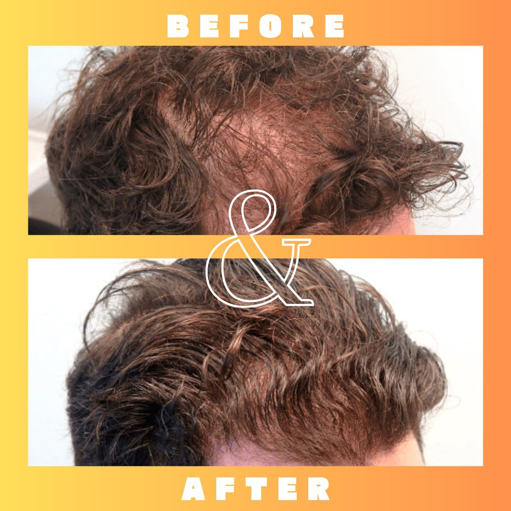 Mettle Mane RU58841 scalp closeup illustrates product contact with skin.