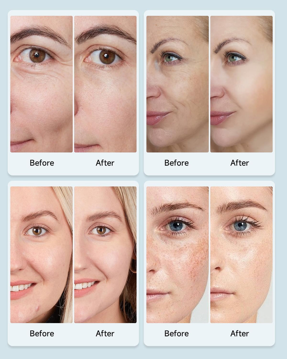 mibiitty-beauty-led-mask-charging-cable compact power option