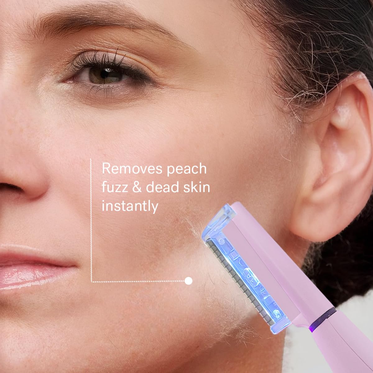 MICHAEL TODD Microsmooth exfoliation tips enhance gentle dermaplaning results.