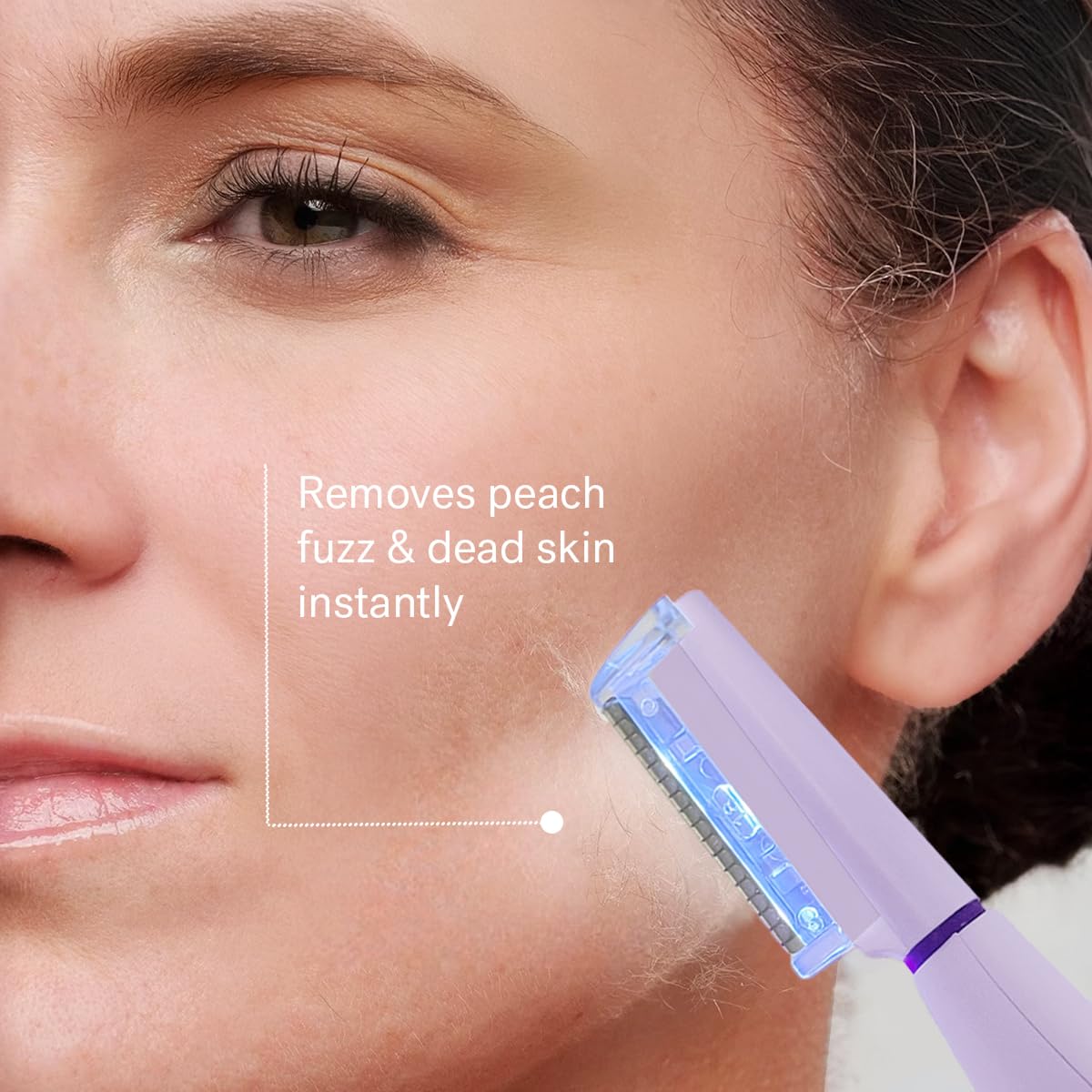 Peach fuzz remover on Michael Todd Sonicsmooth Pro Plus for quick, gentle removal