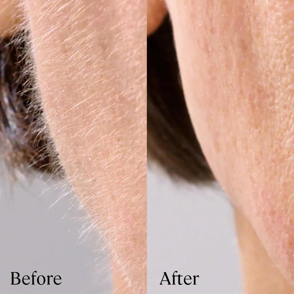 Graphic shows compatibility with all Michael Todd dermaplaning models for versatile use.