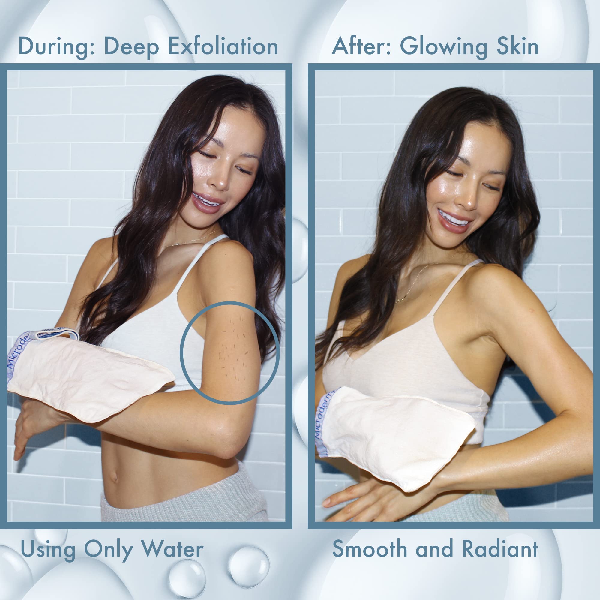 MicrodermaMitt exfoliator targets ingrown hairs for finer, more comfortable skin.