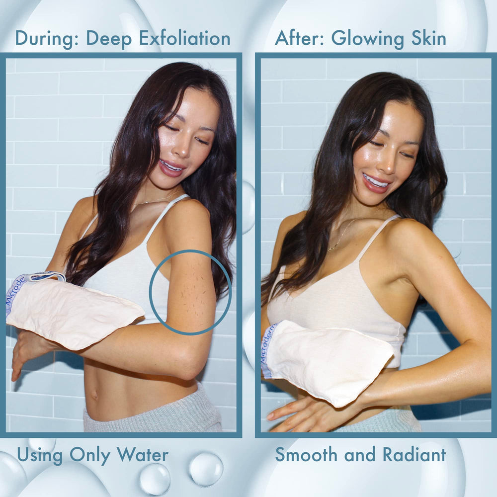 MicrodermaMitt exfoliator targets ingrown hairs for finer, more comfortable skin.
