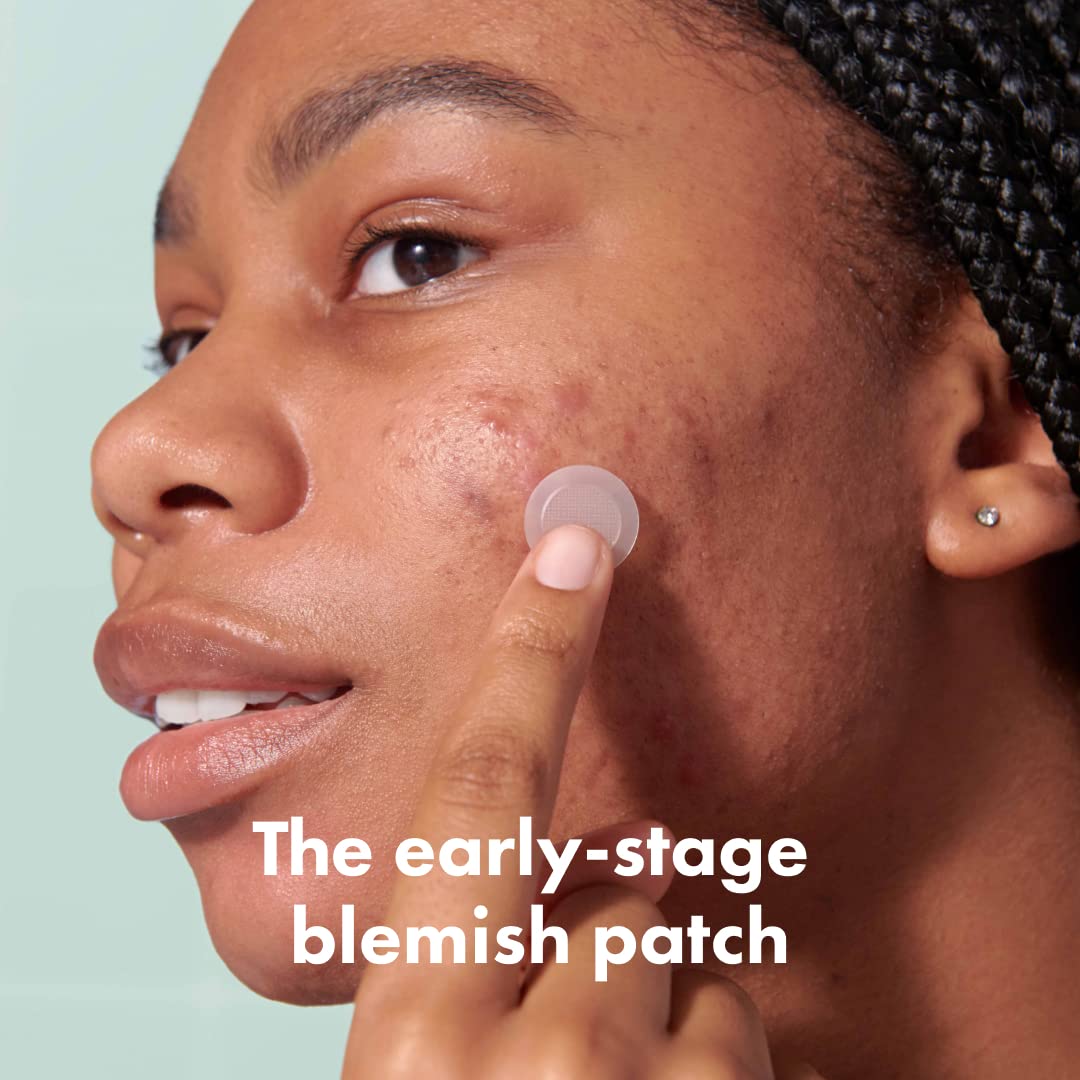 Mighty Patch 395 micropoints close-up showing precision blemish targeting.