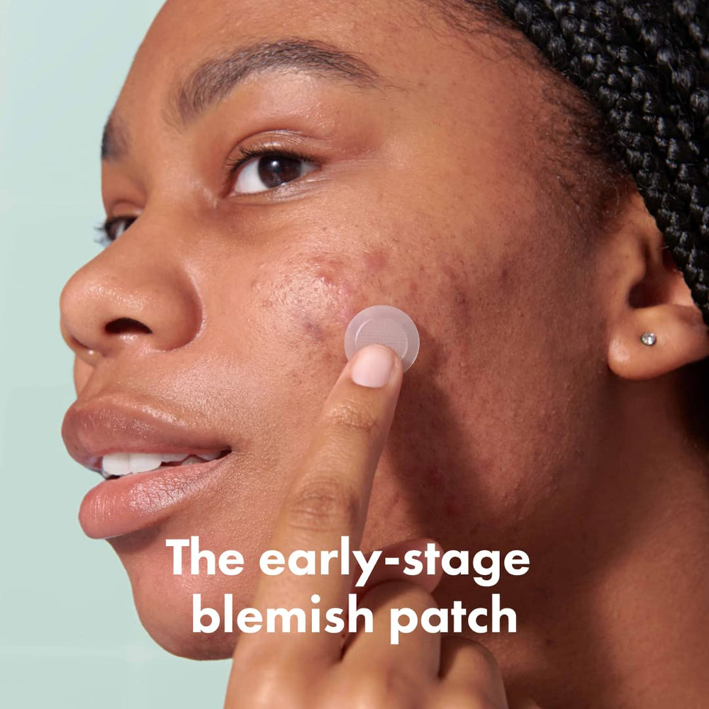 Mighty Patch 395 micropoints close-up showing precision blemish targeting.