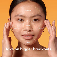 Mighty Patch Face XL nose patch targets mid-face acne securely.