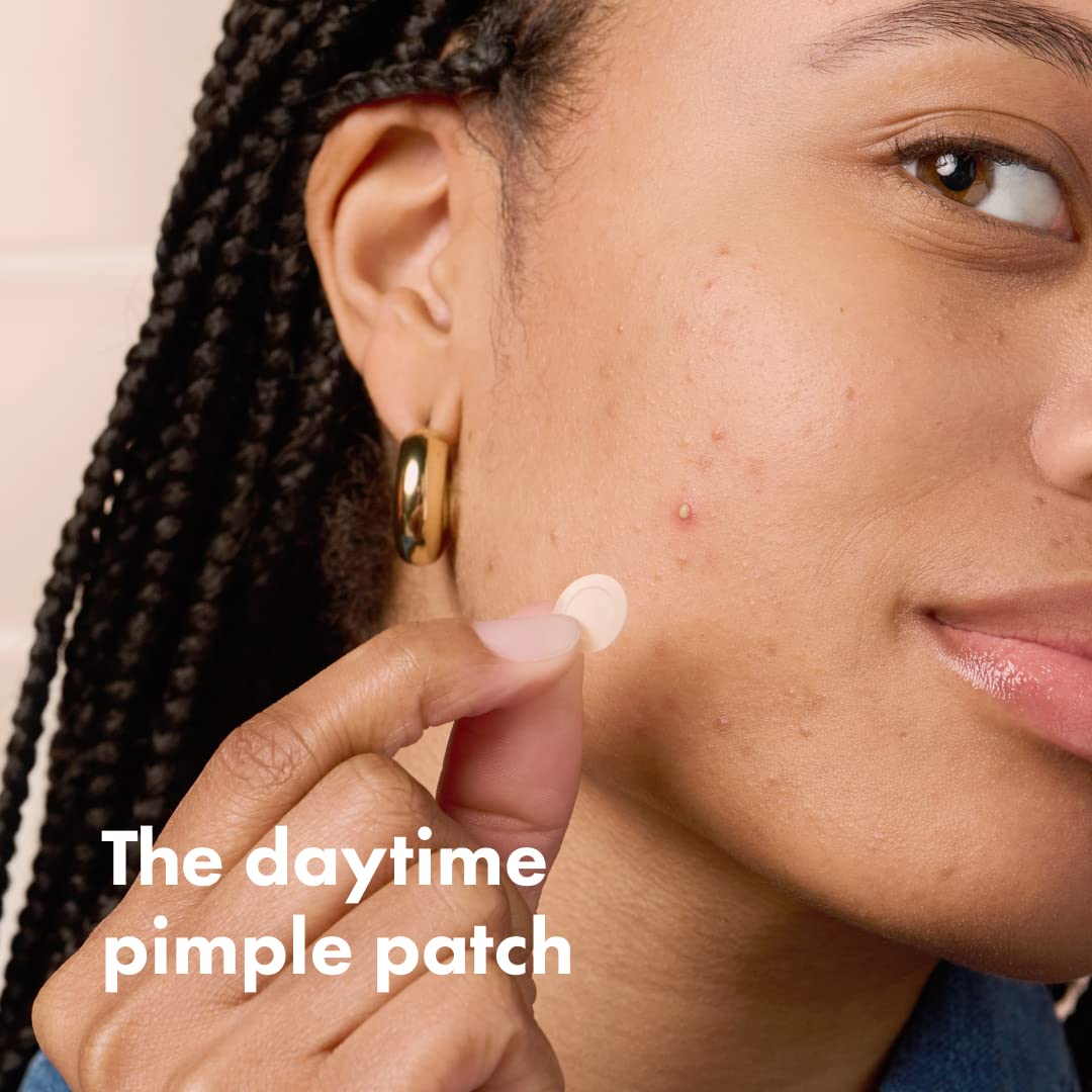 Mighty Patch Invisible+ patch on zit close-up demonstrating near-invisible coverage.