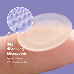 Closeup of dissolving micropoints delivering actives to the skin.
