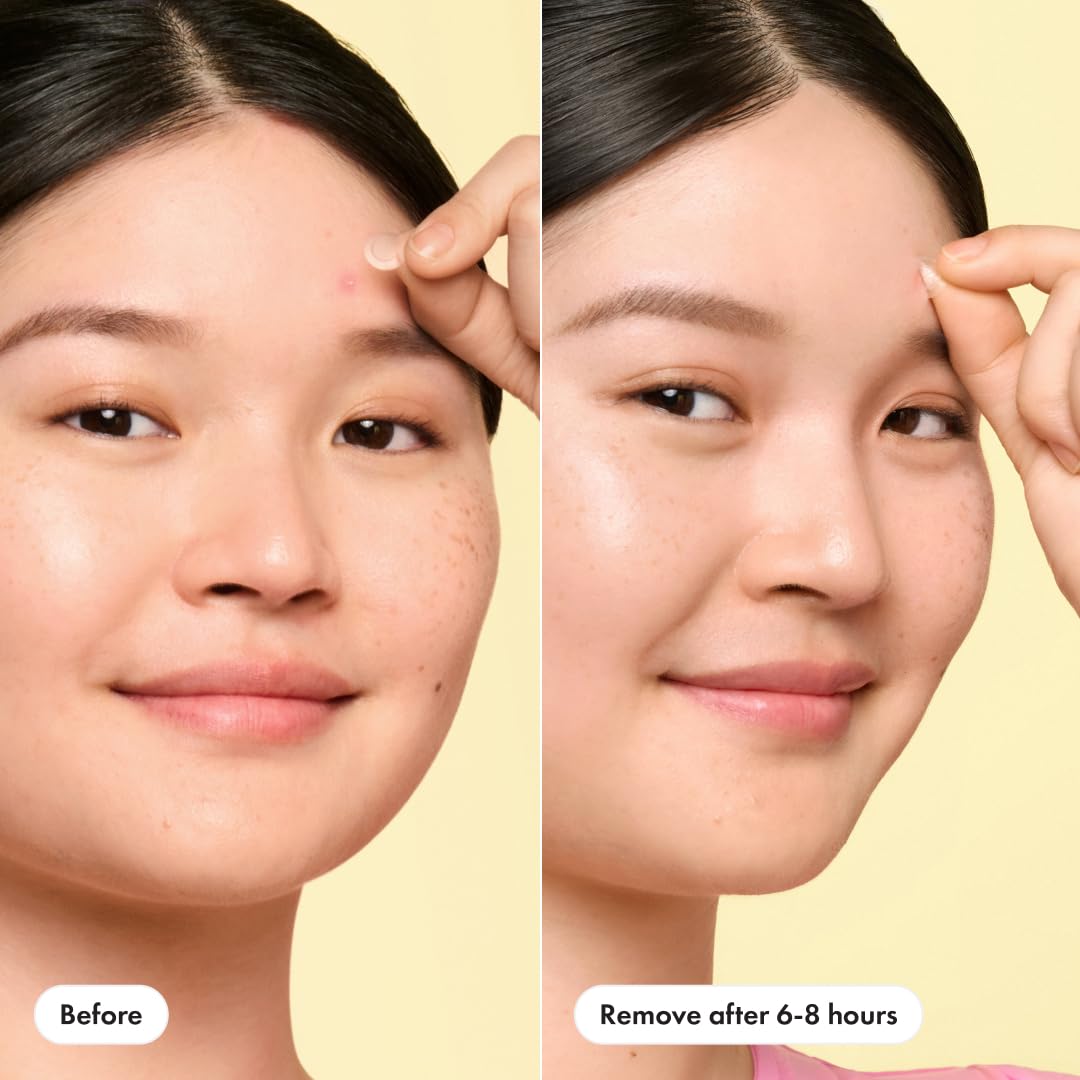 Mighty Patch Mini daytime application under makeup for discreet use