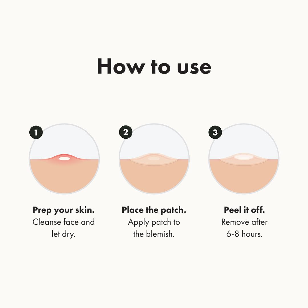 Mighty Patch Original hydrocolloid patch absorbs gunk for potential overnight visibility reduction.