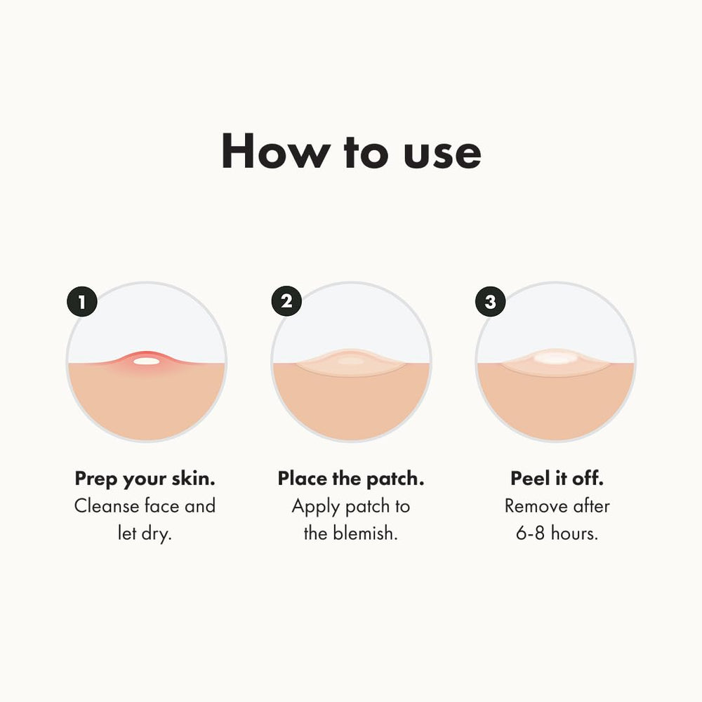 Mighty Patch Original hydrocolloid patch absorbs gunk for potential overnight visibility reduction.