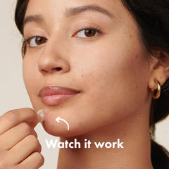 Mighty Patch Original translucent matte film blends with skin for discreet blemish coverage.