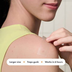 Mighty Patch Surface face-closeup shows discreet, translucent matte finish for confidence throughout the day