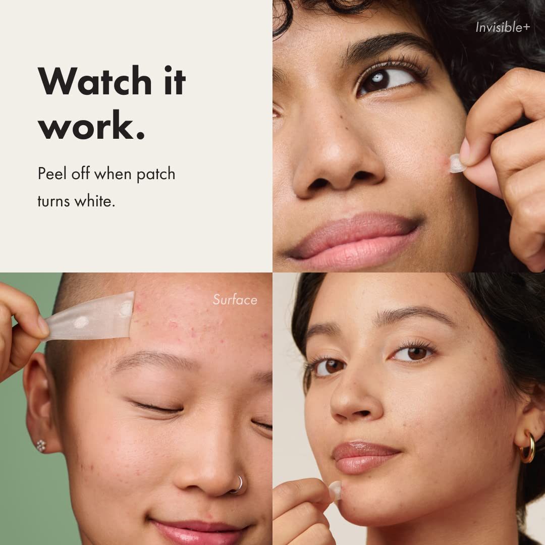 Mighty Patch Surface applied on blemish for quick protection.