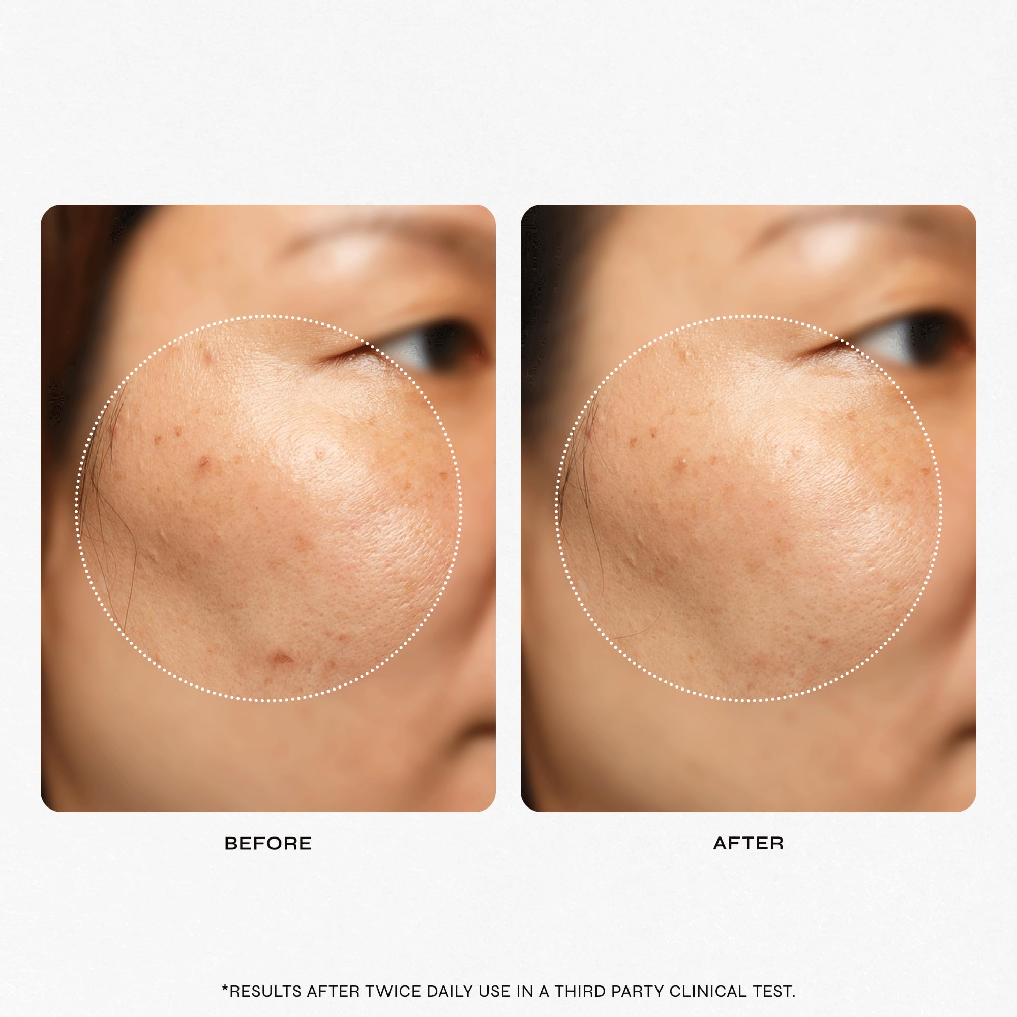 Milani Clean Start texture and tone improvement appears with regular use.