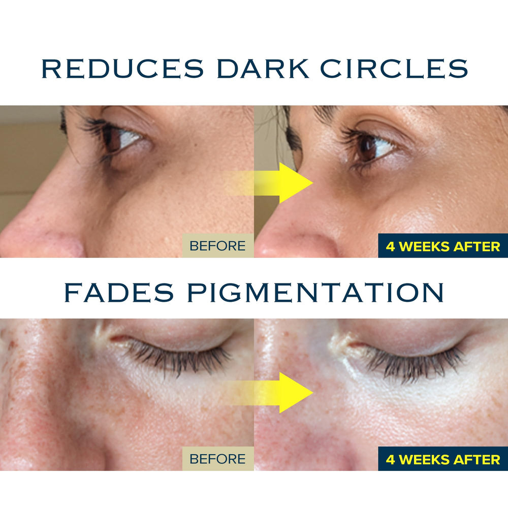 mimmua Dark Spot Ampoule before-and-after comparison showing tone improvement