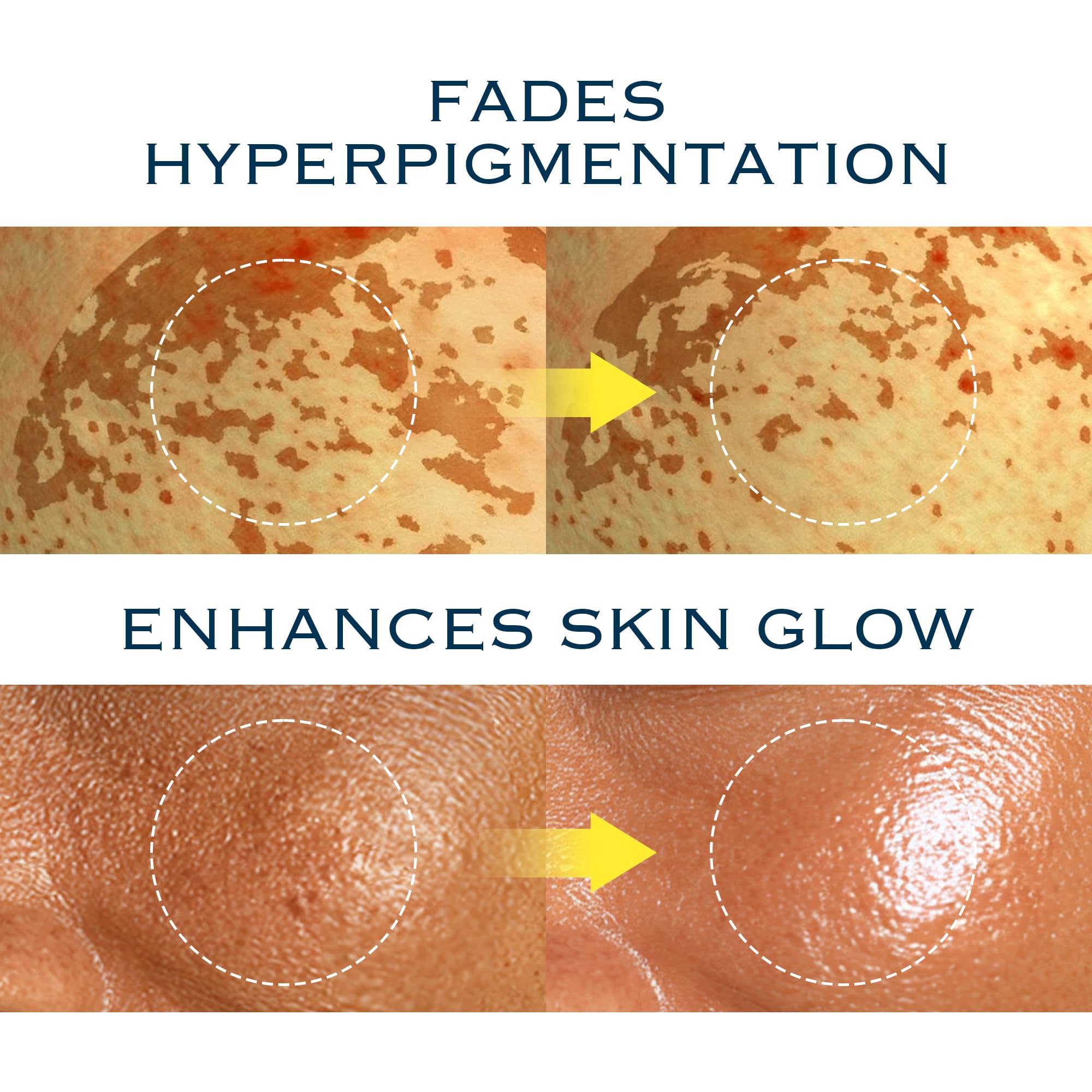 mimmua niacindy before-after style chart showing noticeable brightness and texture improvements