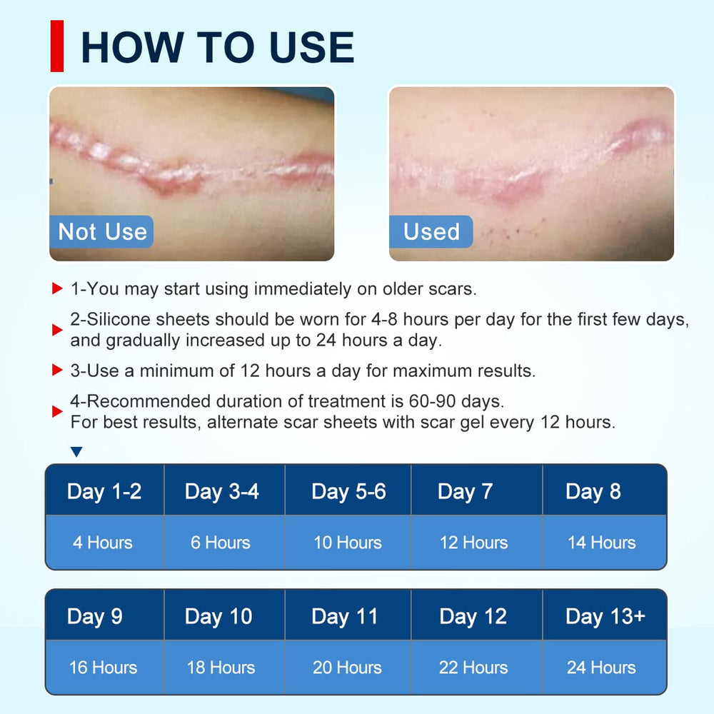 MINGYITUO scar tape adheres securely, creating a moist healing environment for scar management.
