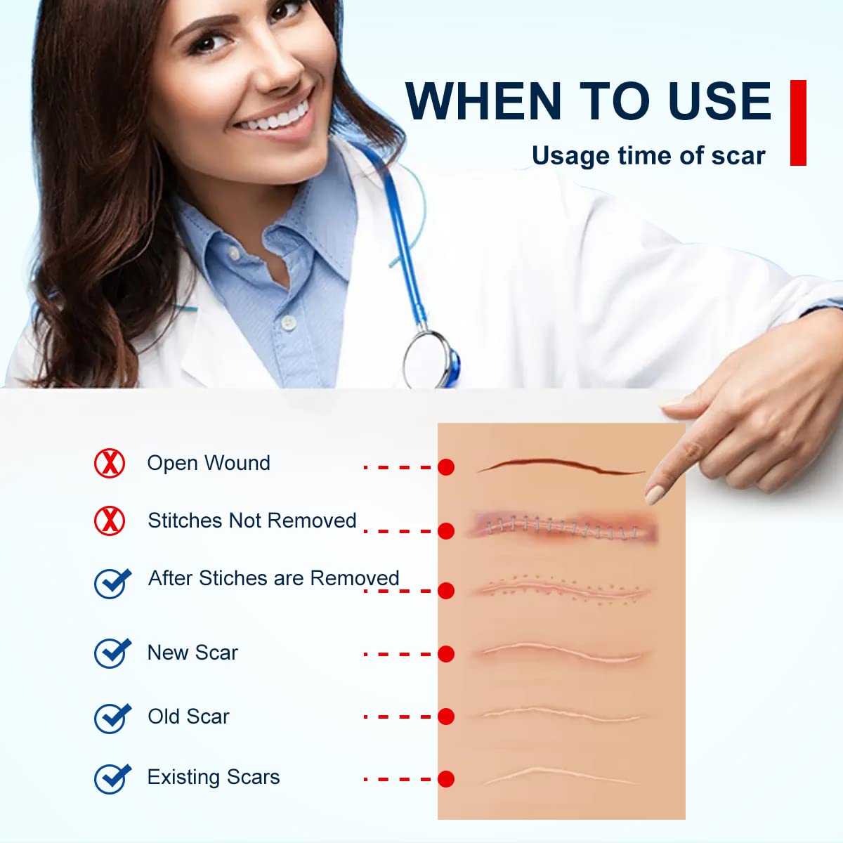 MINGYITUO silicone scar tape being applied and removed with gentle, pain-free simplicity.