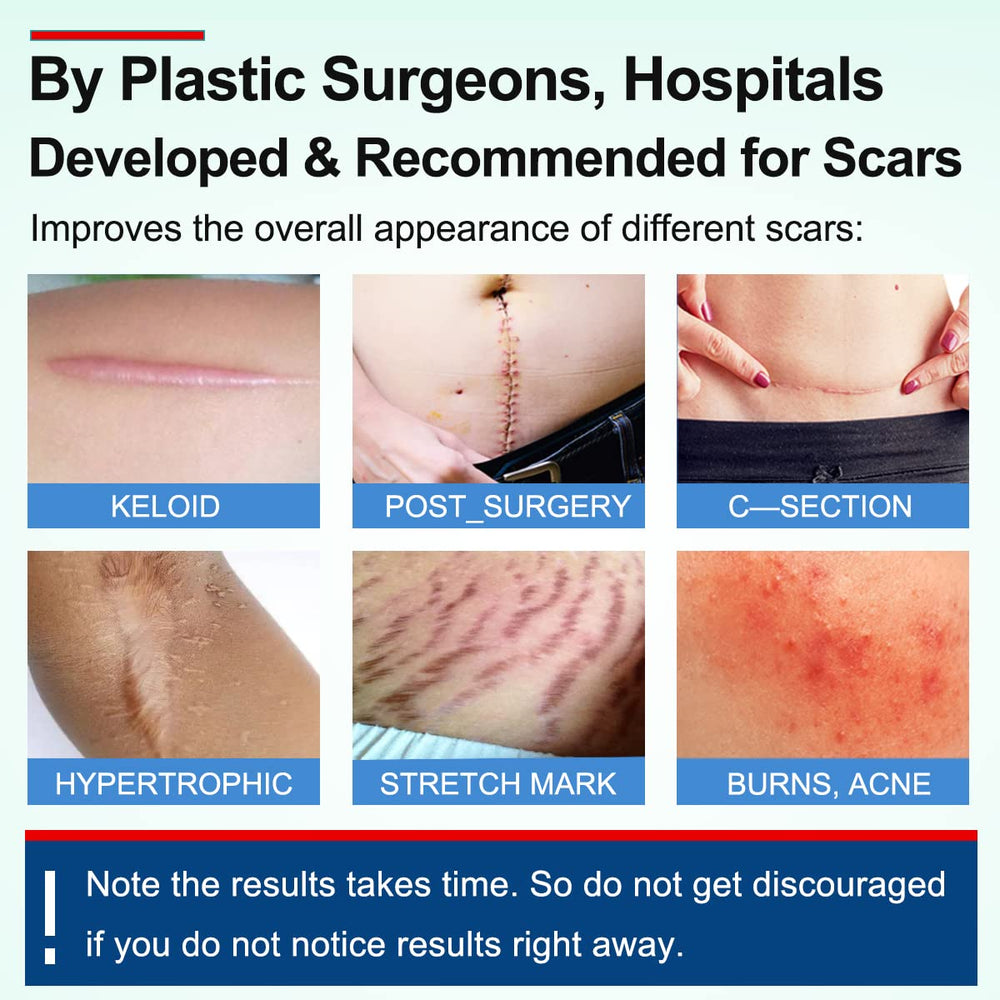 MINGYITUO silicone scar tape on skin demonstrates flexible, discreet adhesion for various scars.