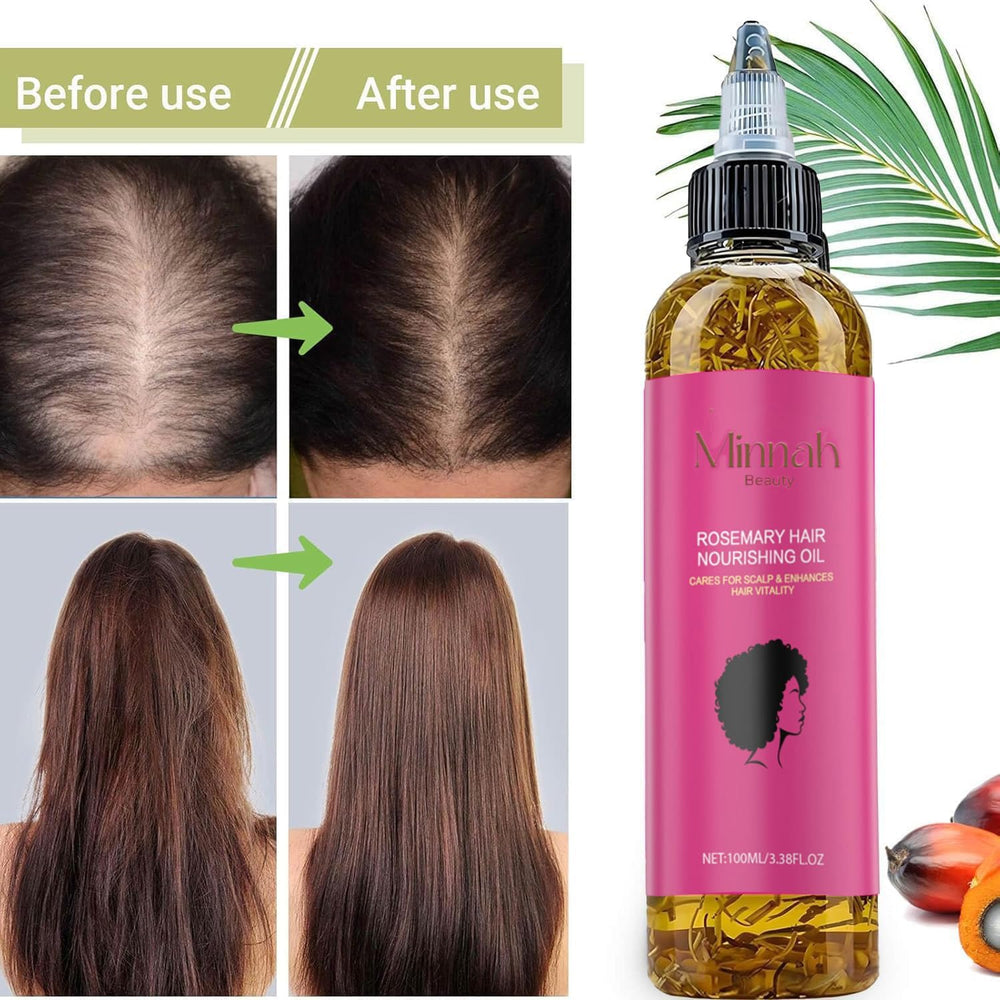 Minnah Beauty Hair Growth Oil texture is lightweight and non greasy.