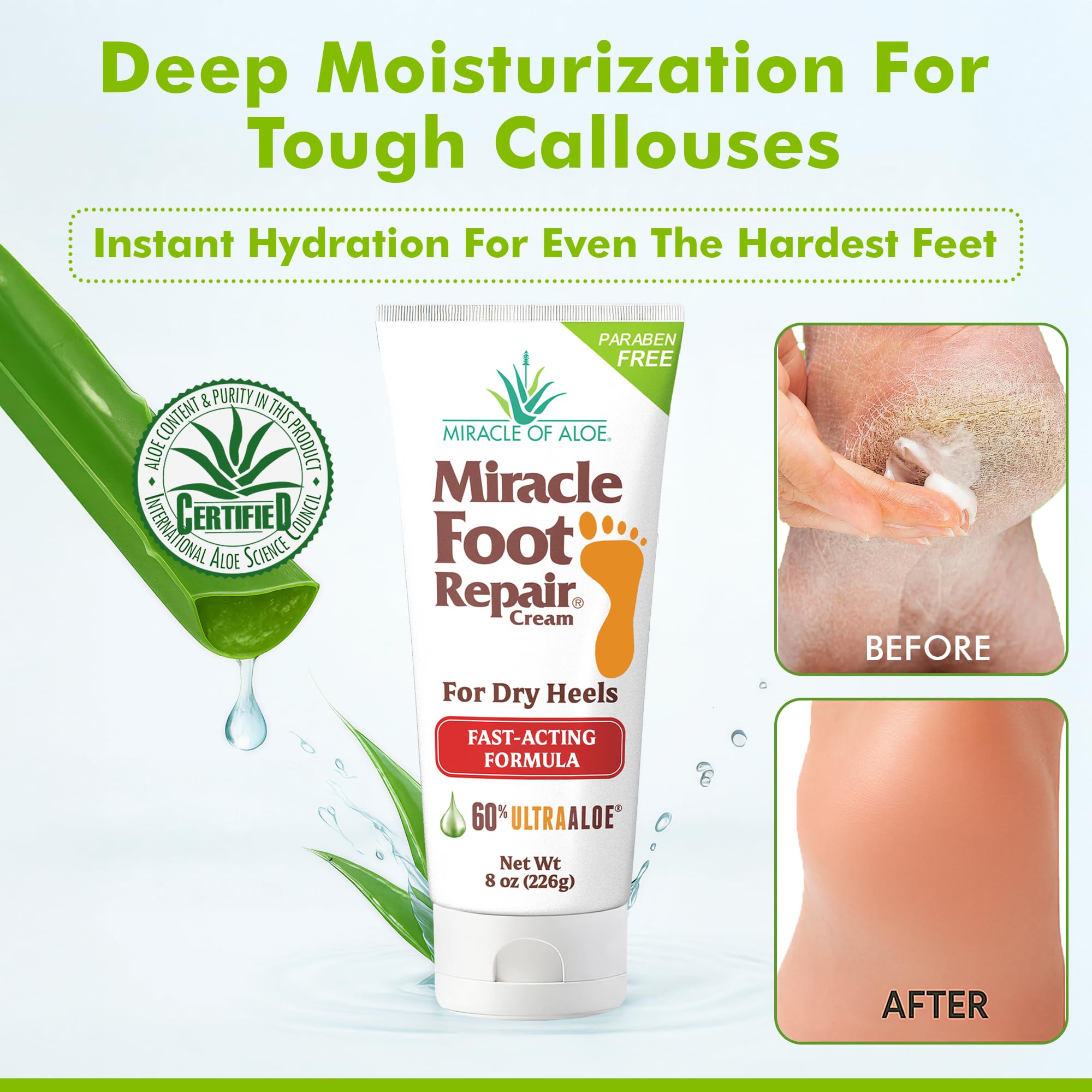 Miracle of Aloe cream texture close-up showing silky, fast-absorbing formula.