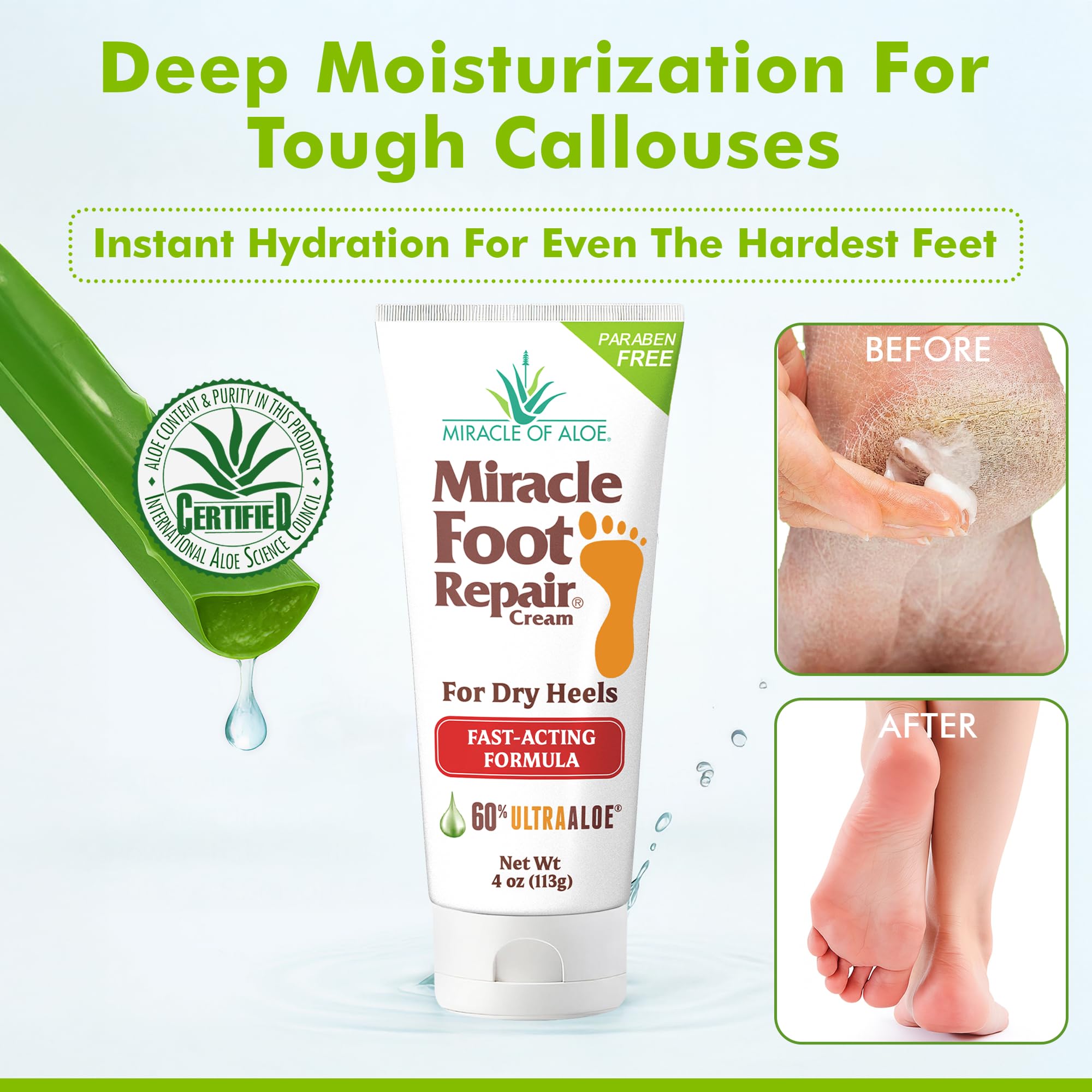 Miracle of Aloe Foot Repair Cream 2-pack front view emphasizes value and ongoing care.