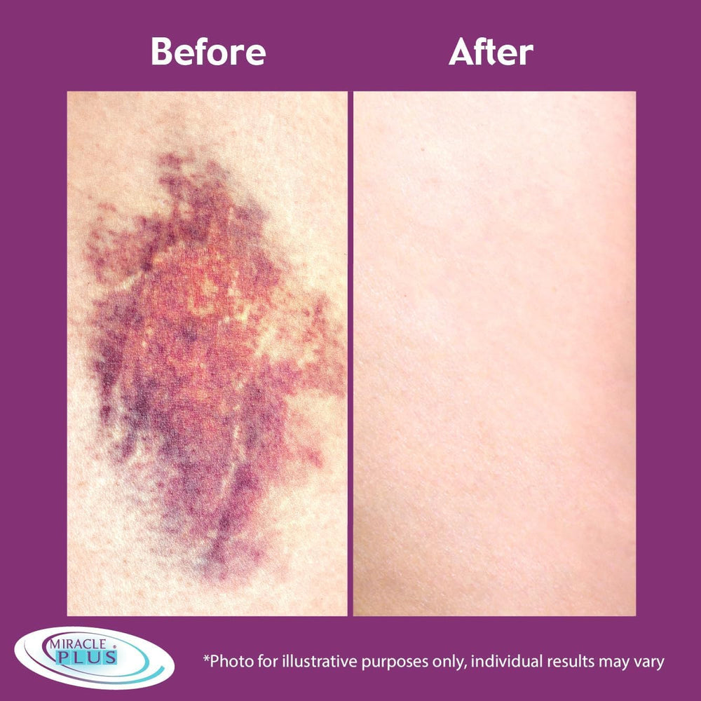 Miracle Plus Arnica Cream closeup emphasizes hydration and care for distressed skin