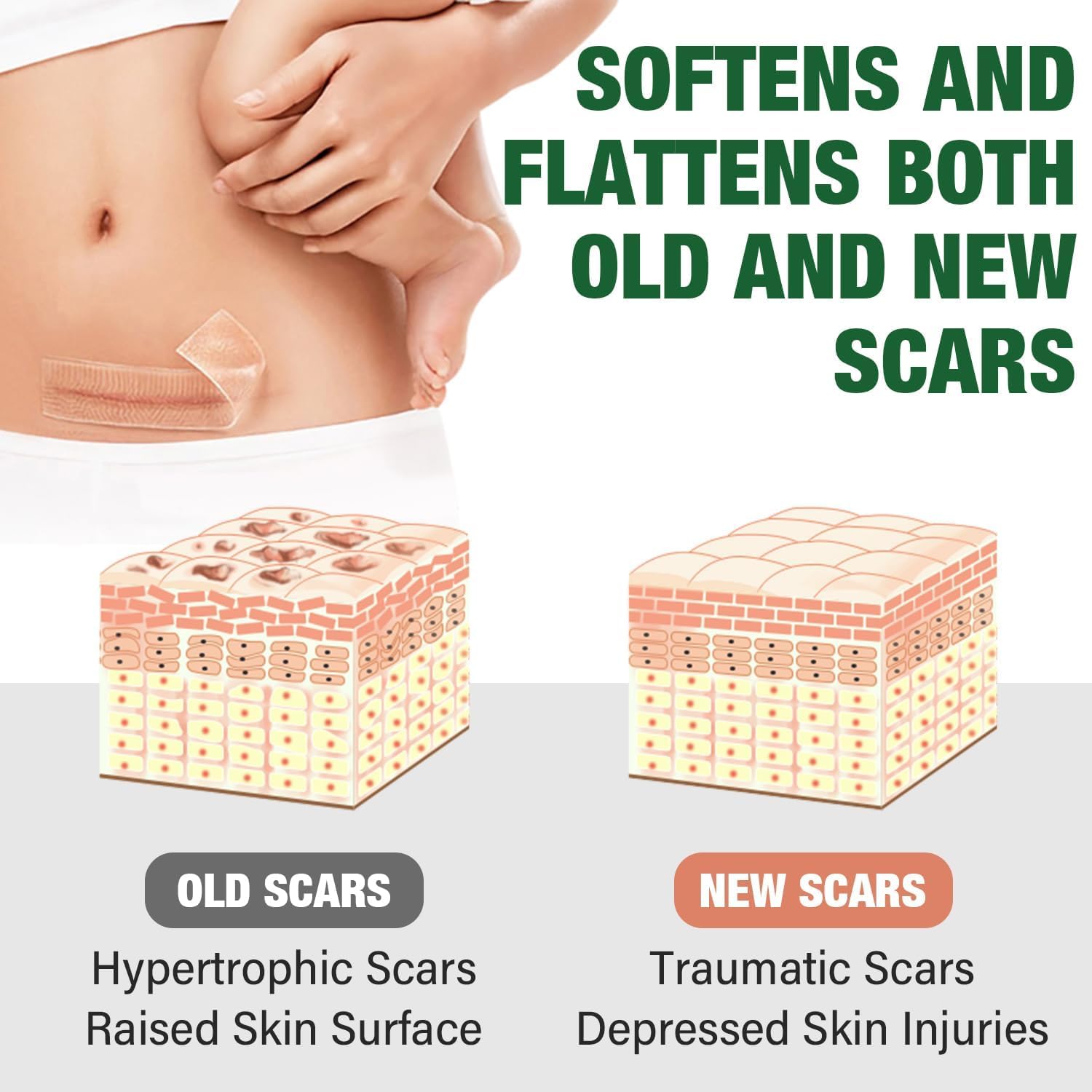 Mitreal keloid bump removal visuals suggesting smoother contour and less prominence