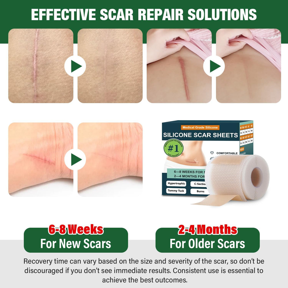 Mitreal scar tape transparent application demonstrates discreet scar protection under clothing