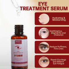 MIZEEYE Styes Eye Relief Serum dropper closeup for easy two-drop application