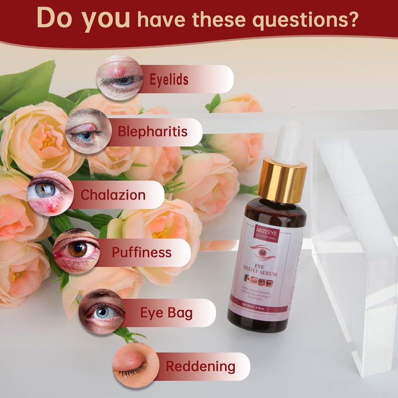 MIZEEYE Styes Eye Relief Serum packaging for convenient daily use