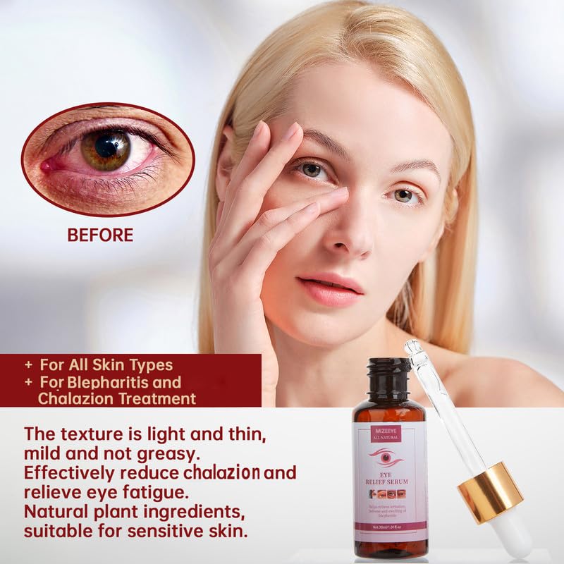 MIZEEYE Styes Eye Relief Serum sea buckthorn ingredients closeup highlighting nourishing moisture