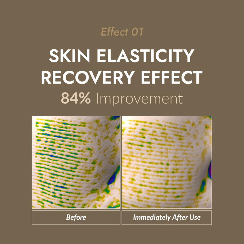 MIZON skin texture closeup suggests smoother appearance and improved tone