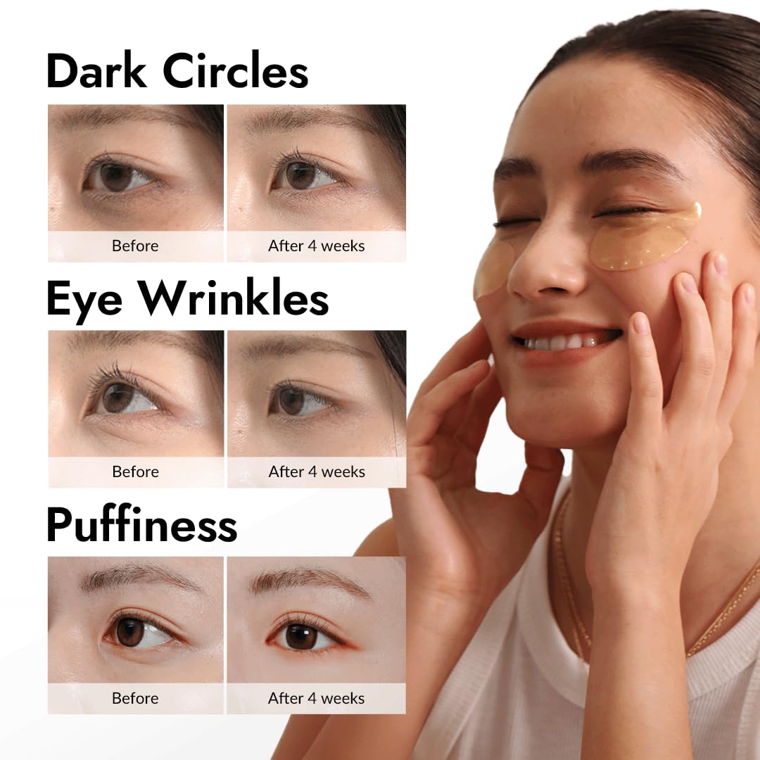MIZON under-eye patches dual-peptides gold emphasize anti-wrinkle support.