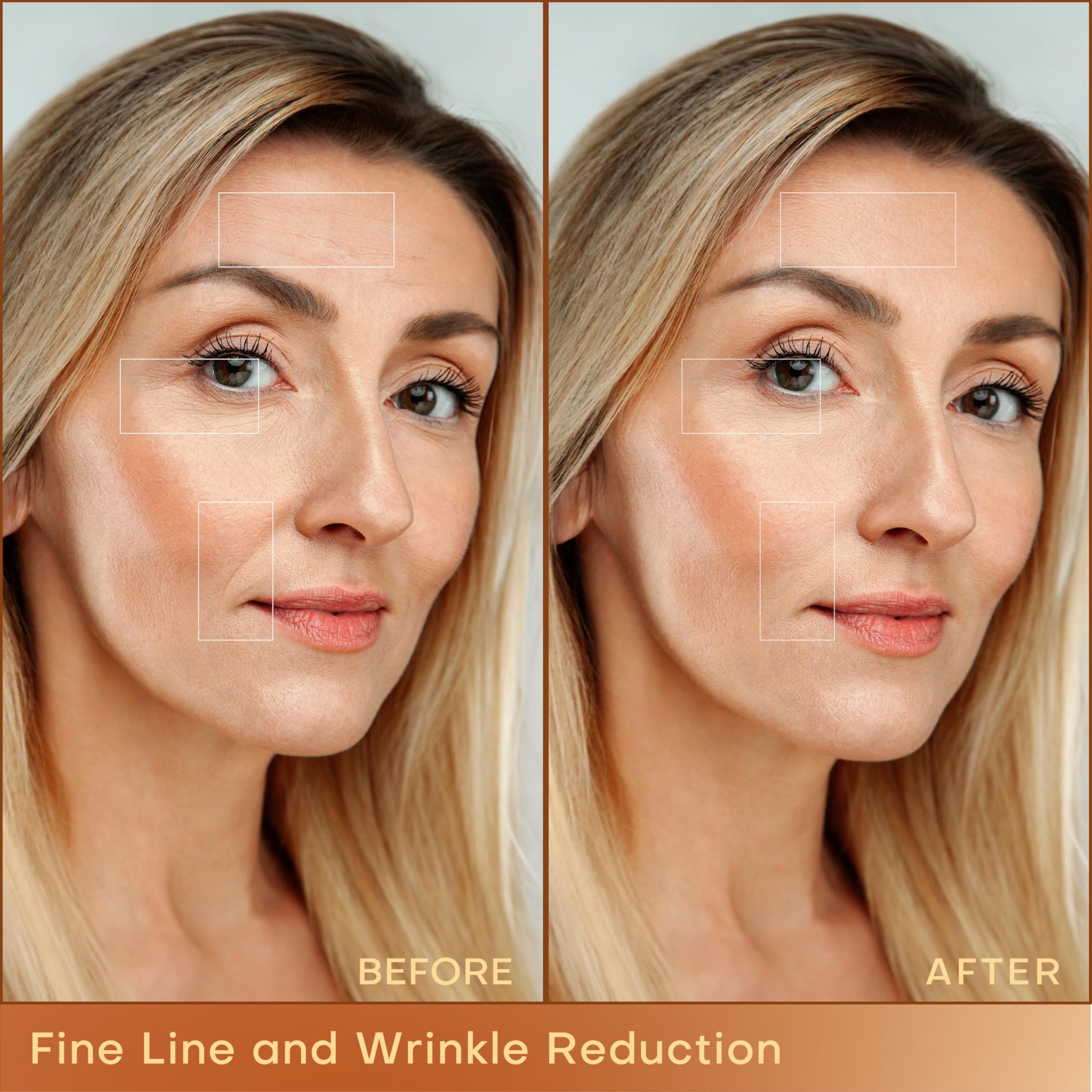 MLAY dual-probe close-up highlighting cheek and jawline tightening.