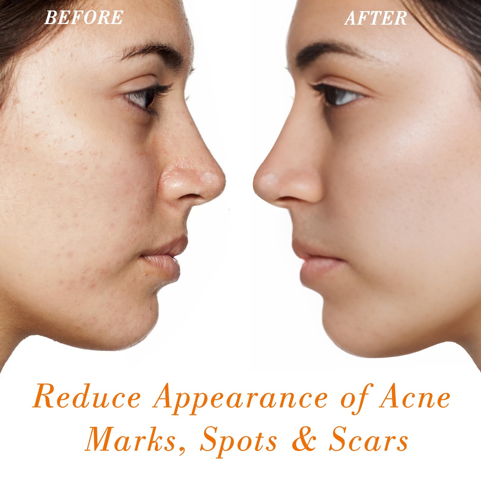 MMPANG Rosehip Oil on face demonstrates nourishing anti-aging support