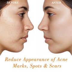 MMPANG Rosehip Oil on face demonstrates nourishing anti-aging support