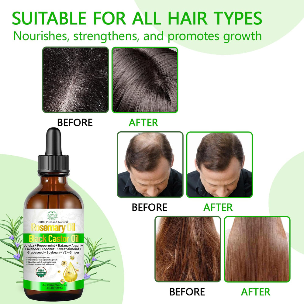 MMPANG rosemary oil dropper pour shows easy application and quick absorption.