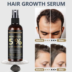 MOC LINK Minoxidil beard growth application near jawline for fuller facial hair