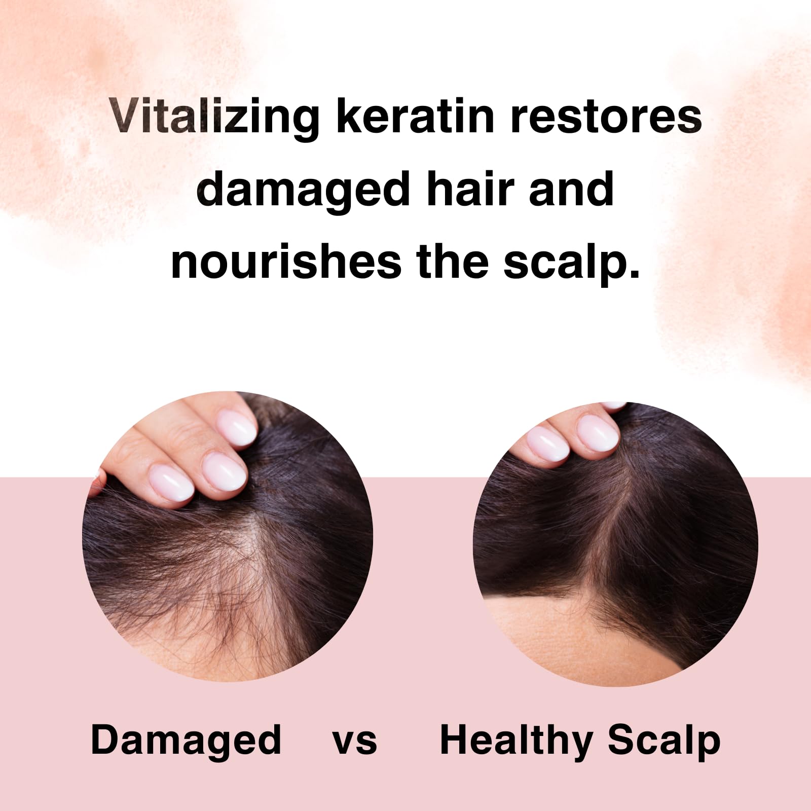 Moist Diane ceramides and botanicals diagram promoting scalp balance.