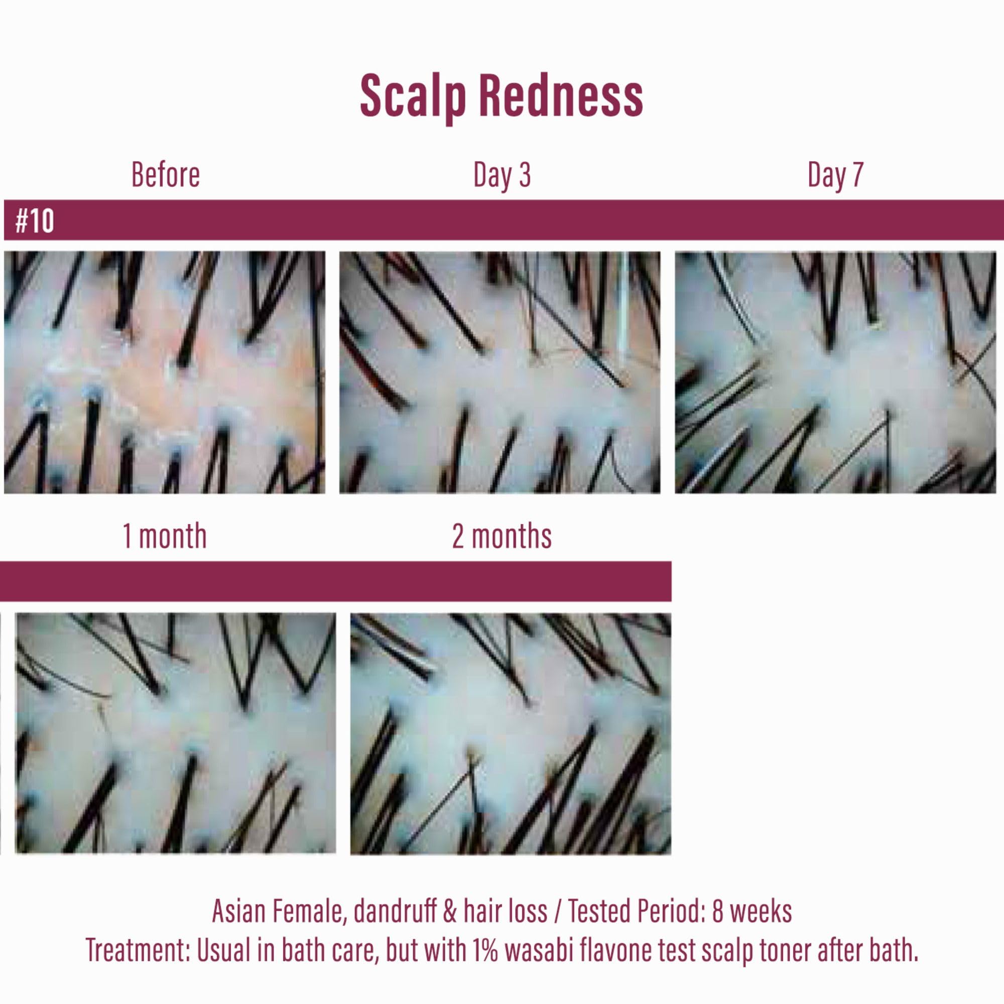 Moist Diane wasabi japonica scalp care image supports balanced scalp.